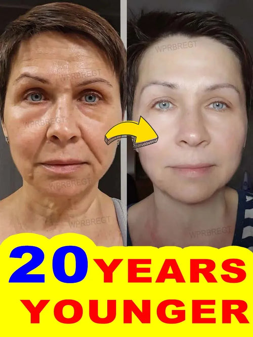 Advanced Structural Smoothing Treatment